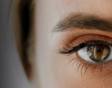 Blepharoplasty