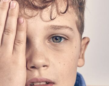amblyopia