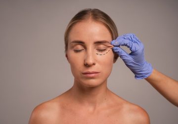 Blepharoplasty