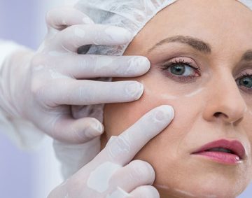Blepharoplasty-min