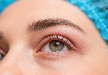Functional Blepharoplasty