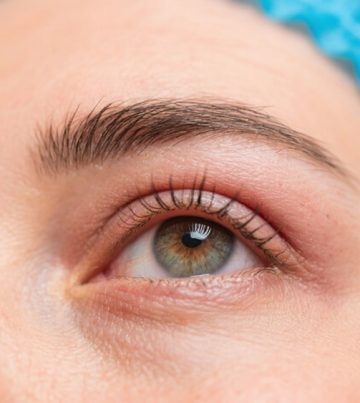 Functional Blepharoplasty