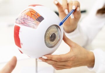 Cataract Lens Surgery-min