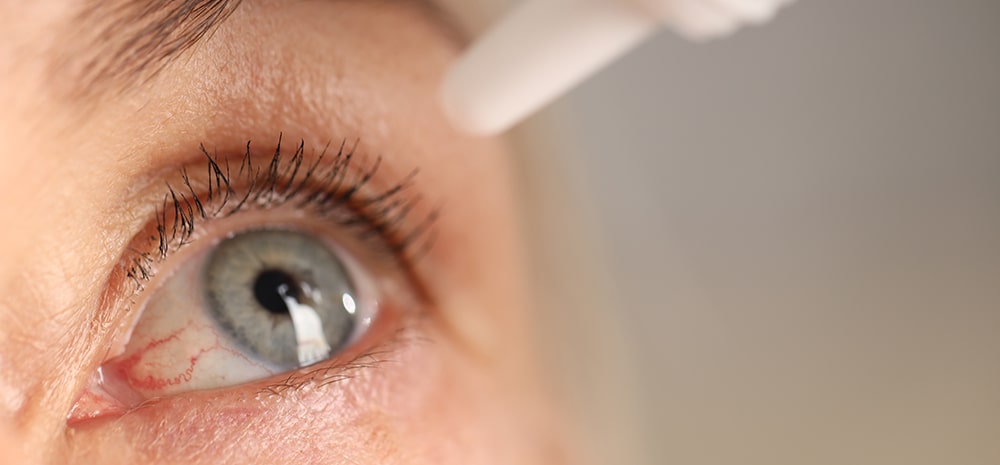Dry Eyes, Watering Eyes & Blocked Tear Ducts: Comprehensive Care at Orbit Eye Center