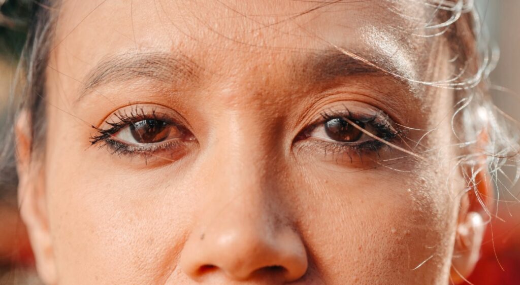 My Eyelids Are Making Me Look Tired All the Time — Is Blepharoplasty the Answer?
